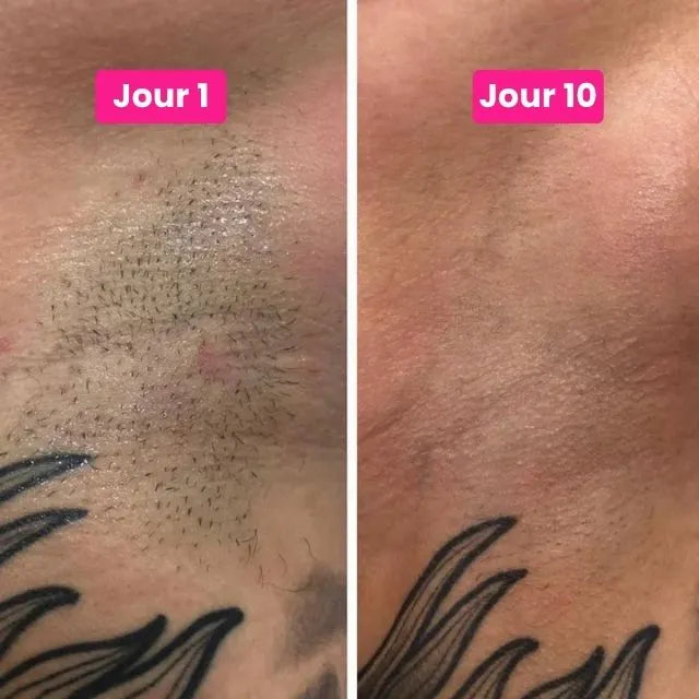 Cypélia™ | Sérum anti-repousse au Cyperus Rotundus