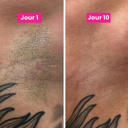 Cypélia™ | Sérum anti-repousse au Cyperus Rotundus